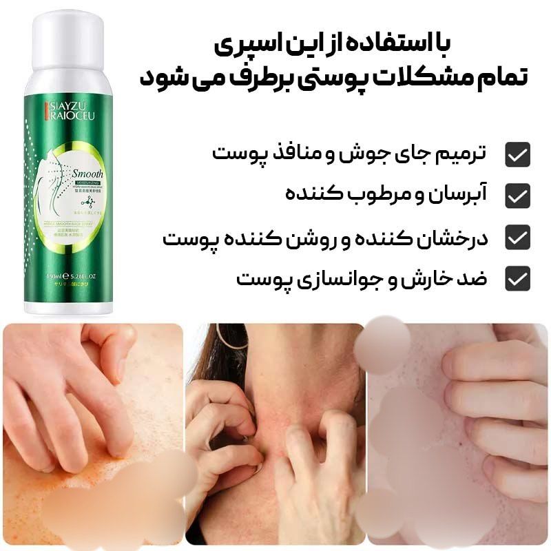 ✨ اسپری ضد جوش بدن سیازو ✨  💧 آبرسان و هیدراته‌کننده پوست 🔸 ضد التهاب و قرمزی پوست 🔹 ضد خارش و اگزما 💖 مرطوب‌کننده و تسکین‌دهنده 🌿 حاوی عصاره سنتلا و مقدار کمی رتینول برای درمان عمقی ✨ از بین برنده جوش و جای جوش 🔸 درمان لک‌های باقی‌مانده از جوش‌های قبلی 🌱 حاوی عصاره آلوئه باربادنسیس و سنتلا آسیاتیکا 💪 مناسب برای جوش‌های بدن مانند بازو، کمر، باسن و کشاله ران